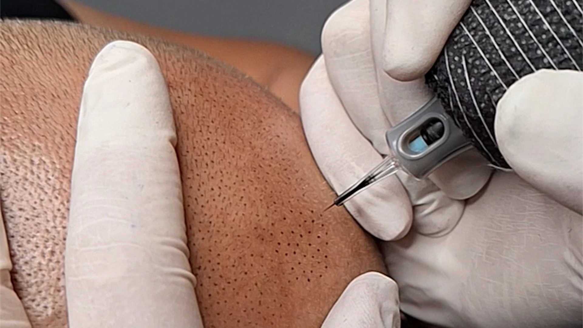 clinica micropigmentación Oviedo