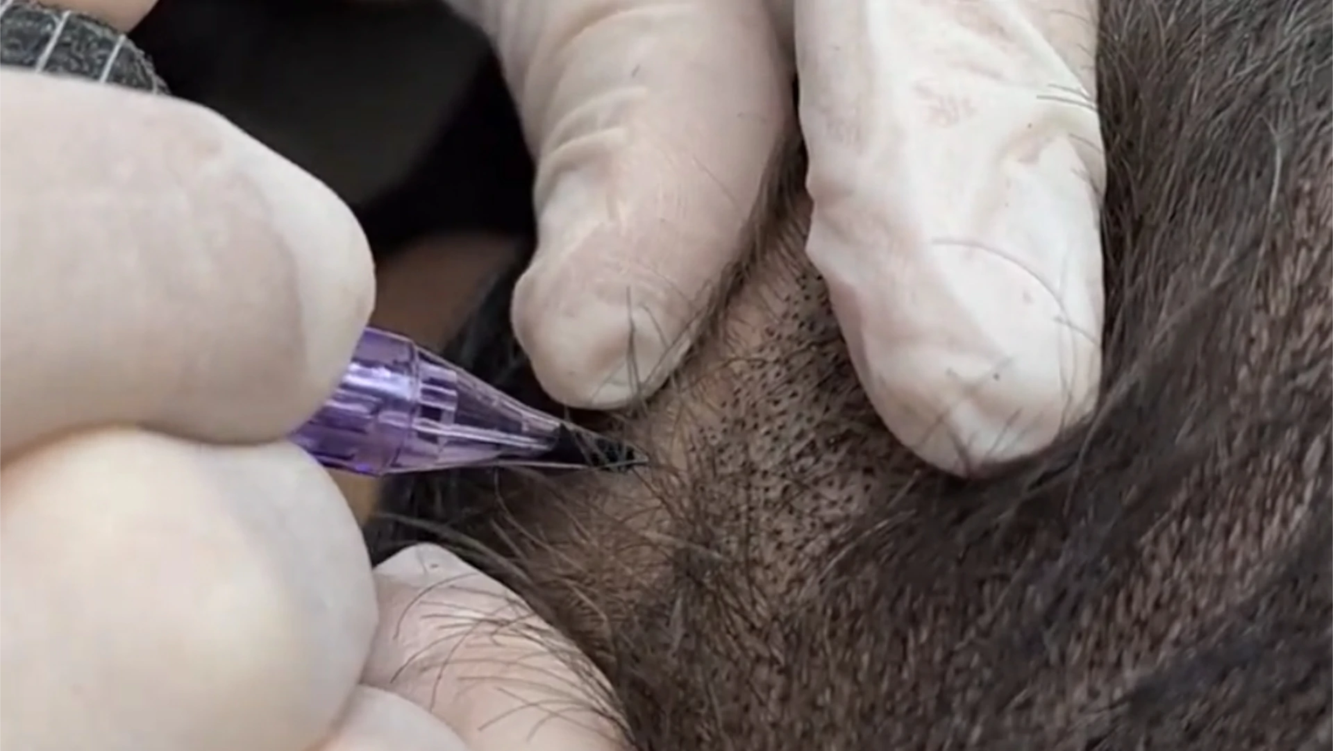 clinica micropigmentación Oviedo